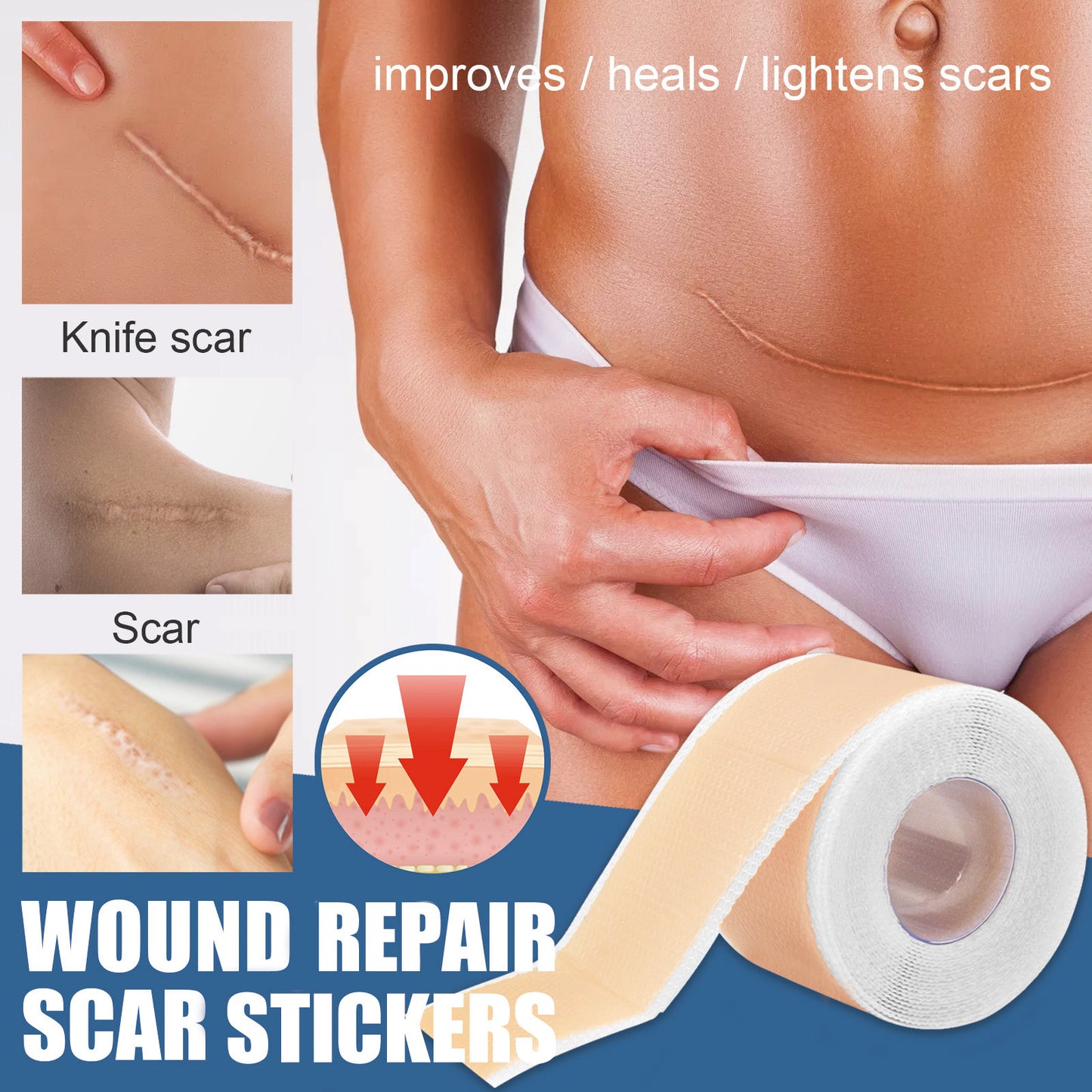 Silicone Scar Tape