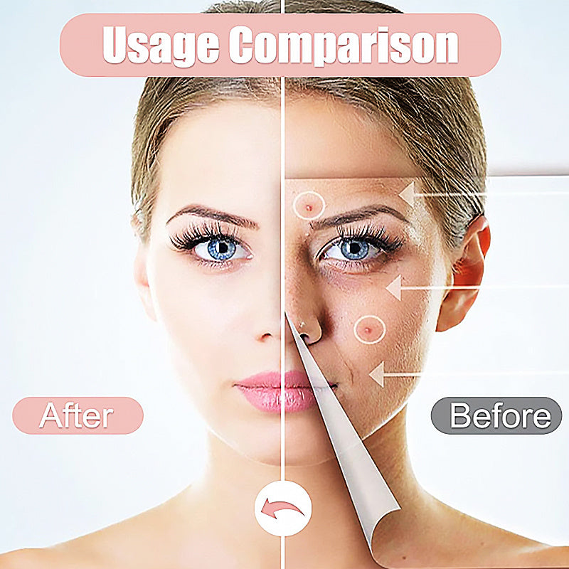 Hugrose Acne Patch Pimple Patch