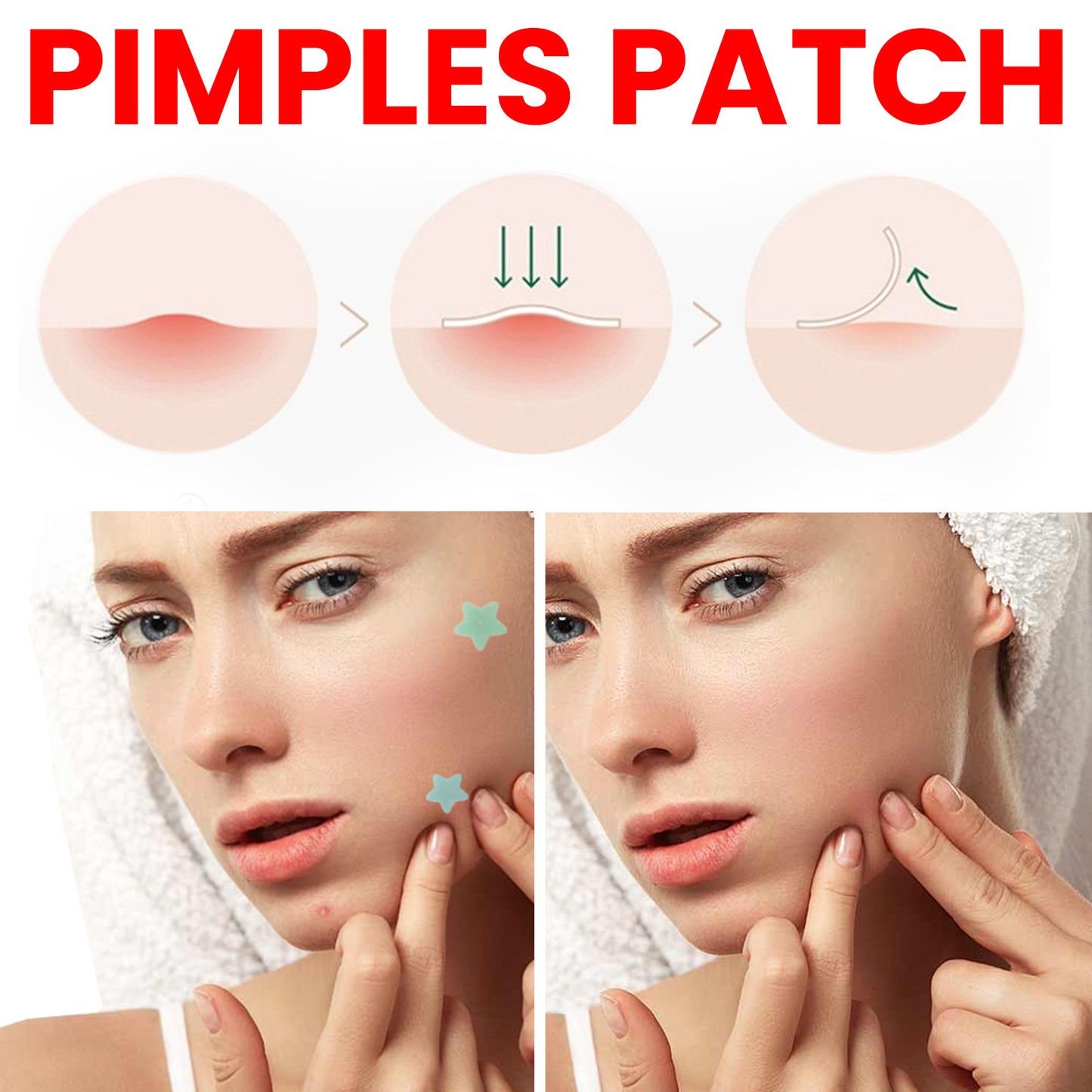 Star Colored Acne Stickers Repair Acne Pits & Marks Fade Acne Spots Blemishes Cover Acne Pimples